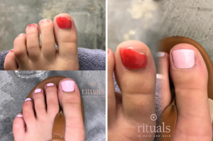 ingrown toenails rituals